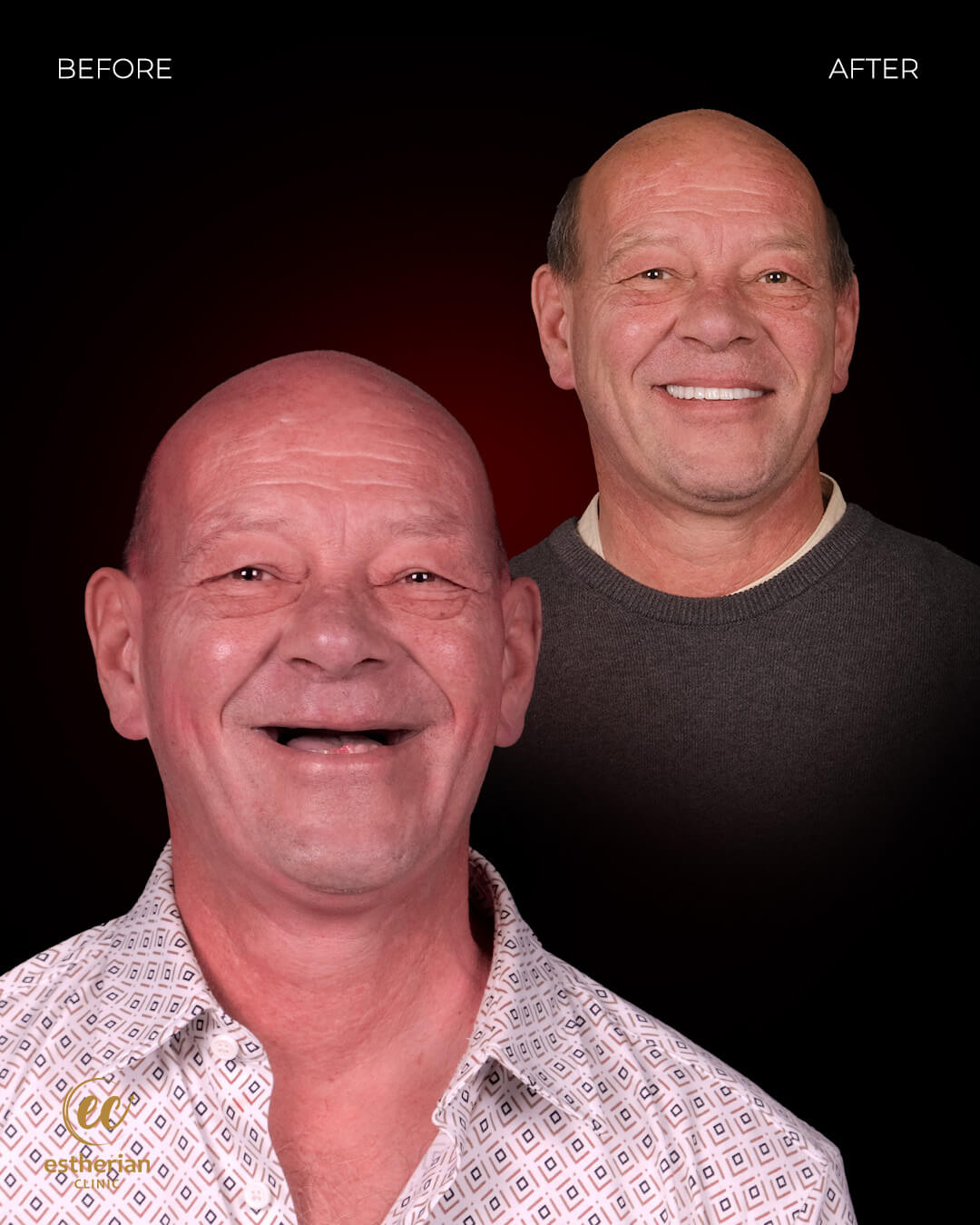 Smile Makeover Before After 10