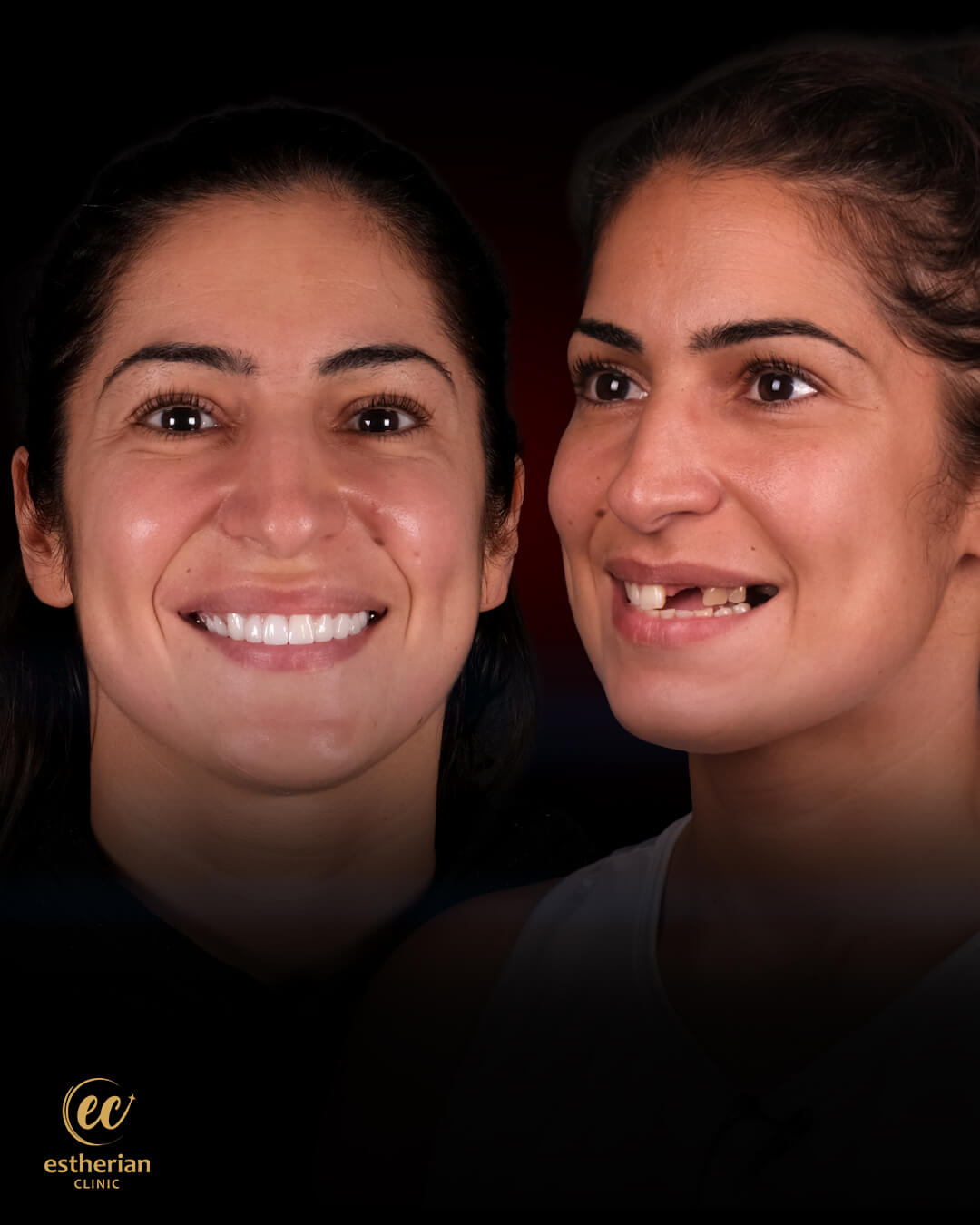 Smile Makeover Before After 12