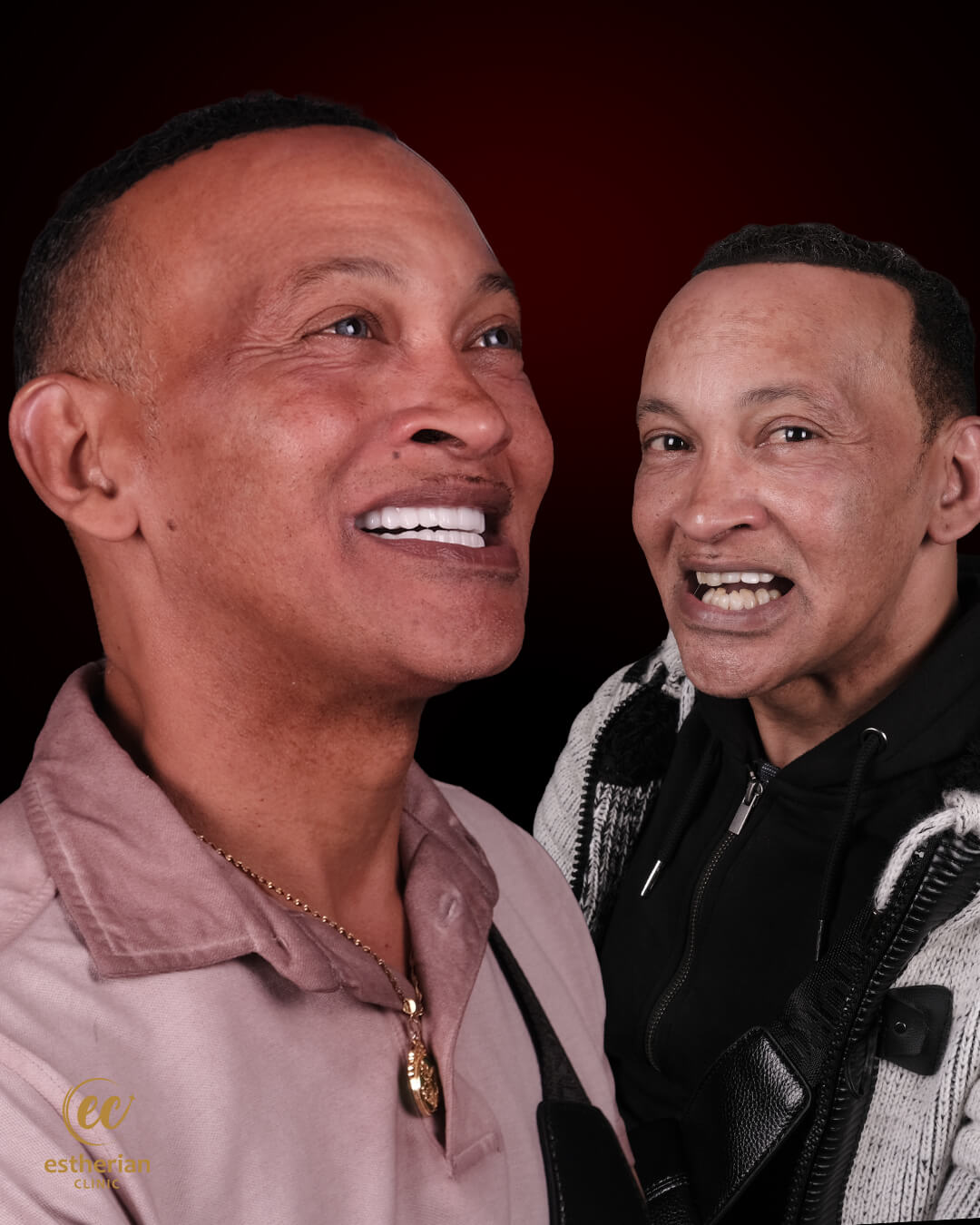 Smile Makeover Before After 13