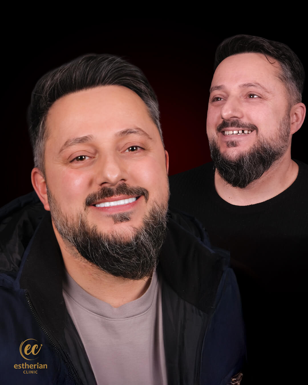 Smile Makeover Before After 14