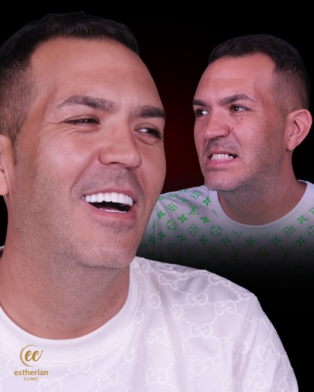 Smile Makeover Before After 15