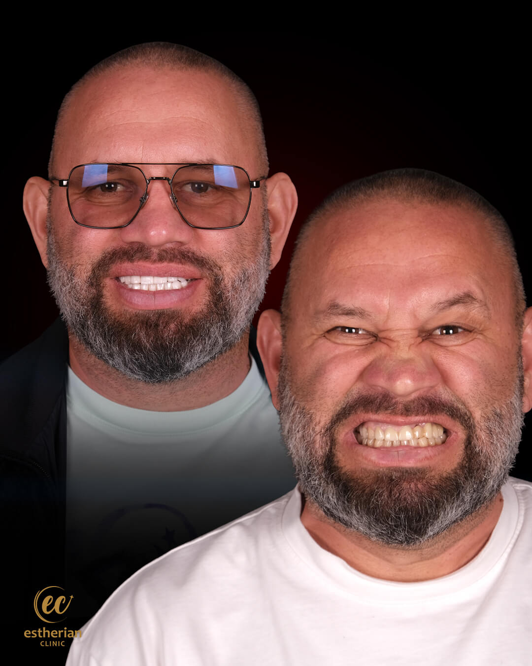 Smile Makeover Before After 16