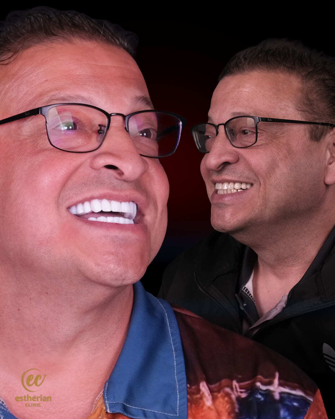 Smile Makeover Before After 17