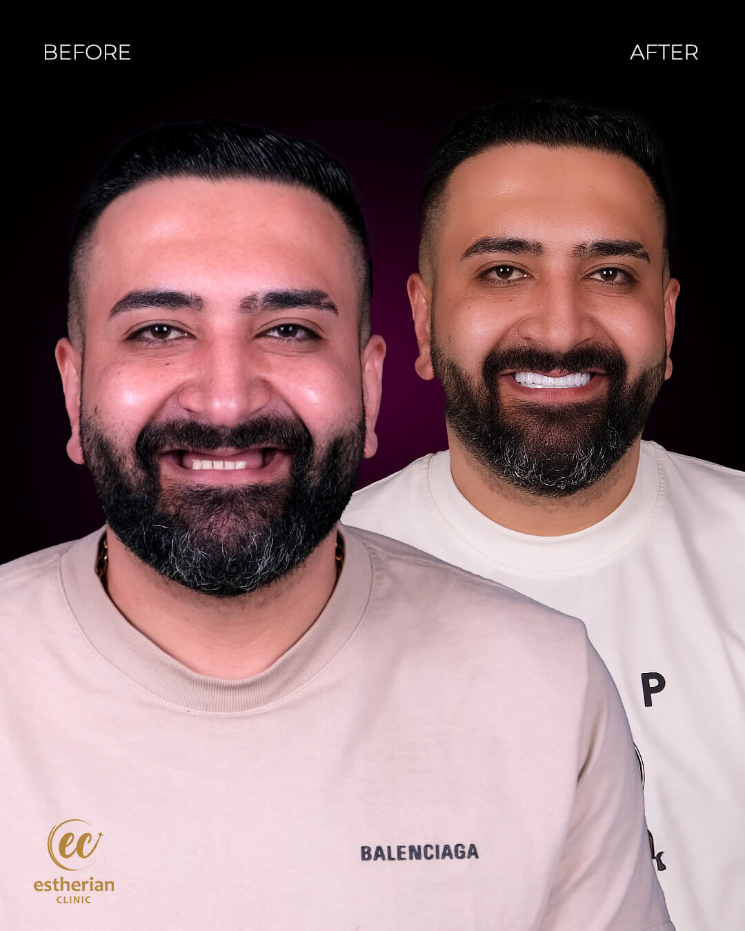 Smile Makeover Before After 18