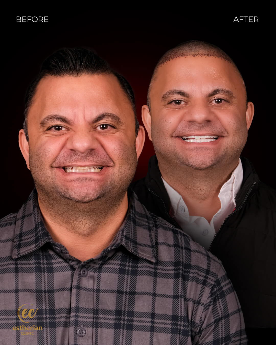 Smile Makeover Before After 20