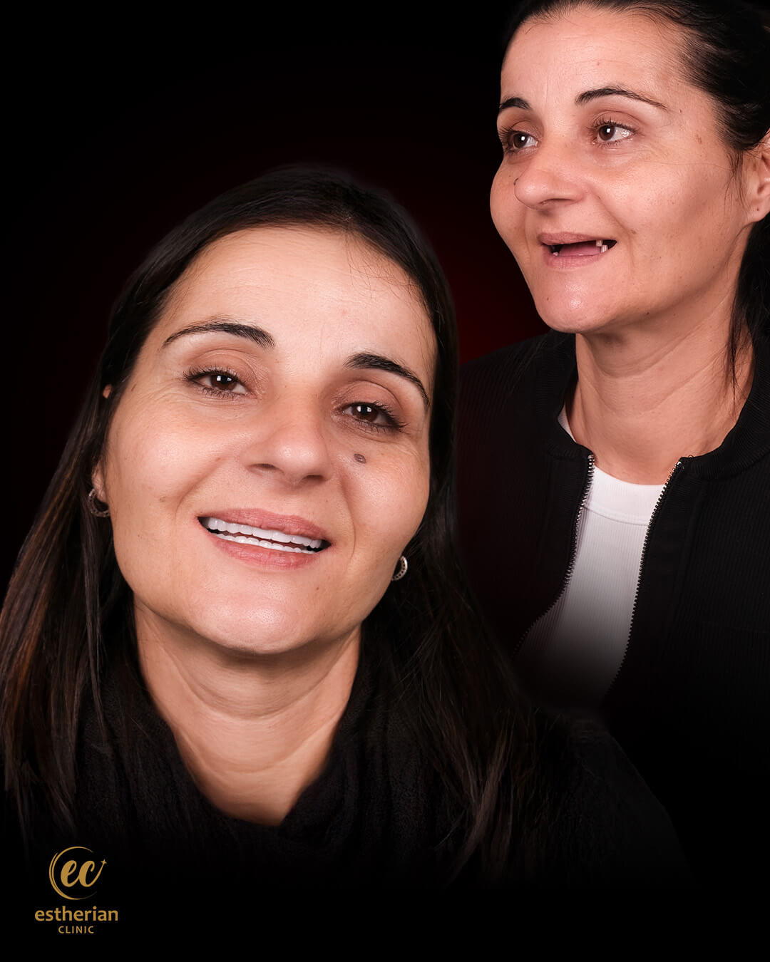 Smile Makeover Before After 5