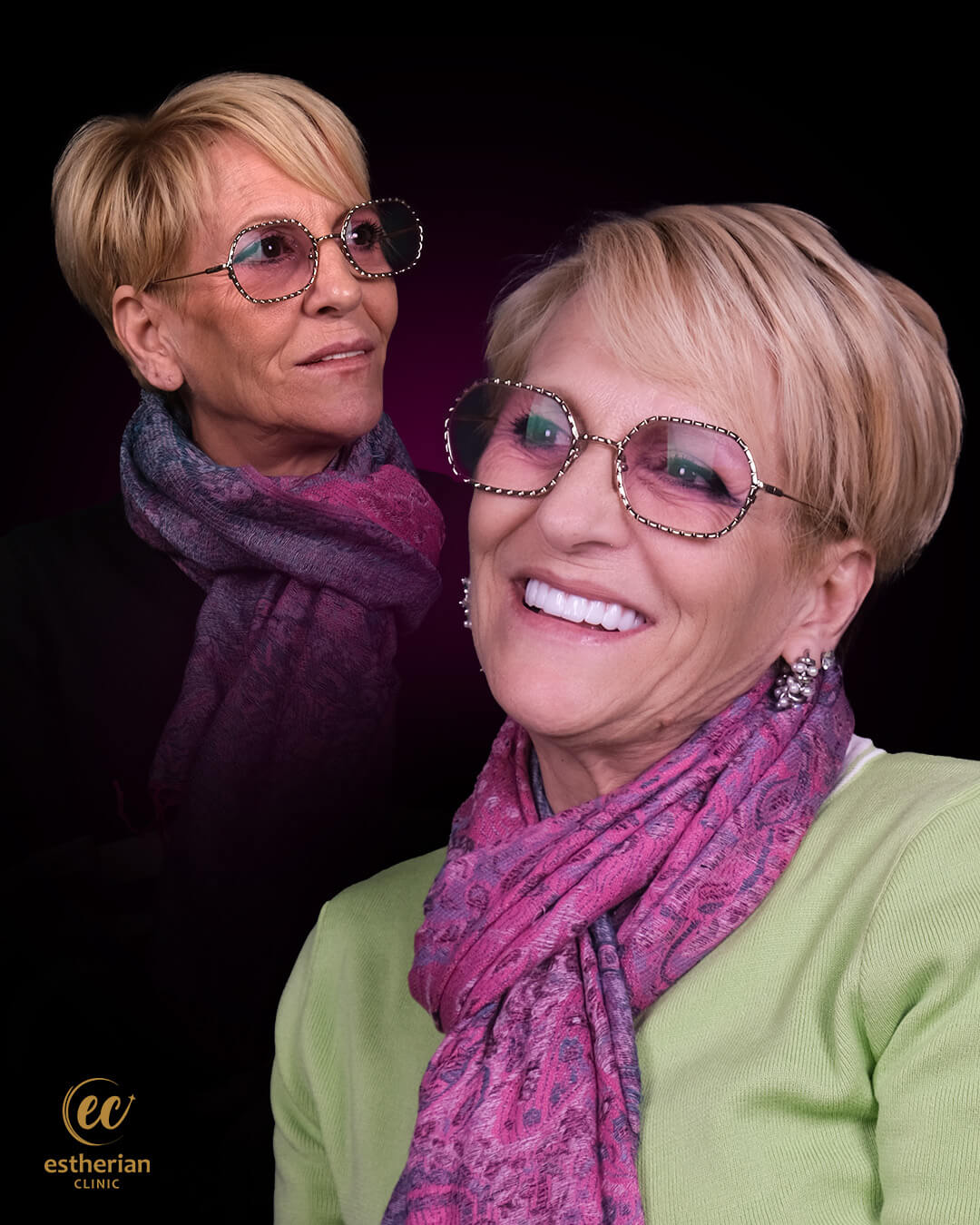 Smile Makeover Before After 7