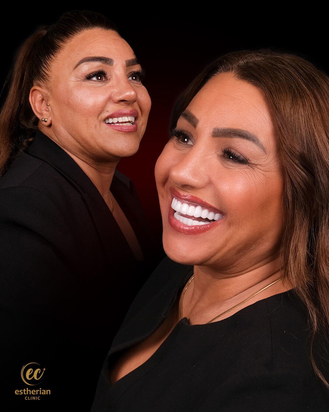 Smile Makeover Before After 8