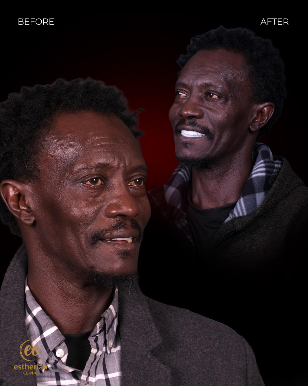 Smile Makeover Before After 9